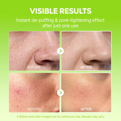 Summer Exclusive | 10-Step Skin Renewal Routine Set